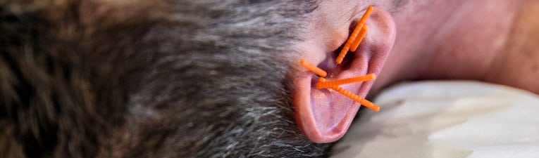 Picture of a patient laying on a examination table with acupuncture needles in their ear.