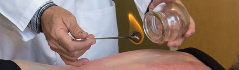 Picture of a demonstration of cupping technique.