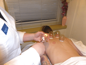 Picture of a student applying cupping techniques to a patient in the student acupuncture clinic.